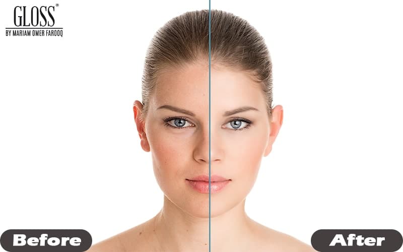 سات دن میں نرم جلد کیسے حاصل کریں – ضمانت شدہ علاج۔